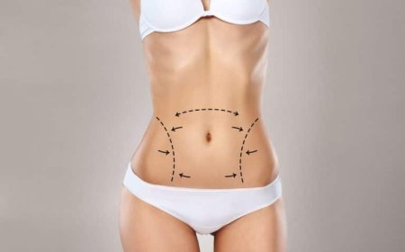 Liposuction in Dubai: How to Safely Combine Liposuction with Other Aesthetic Treatments