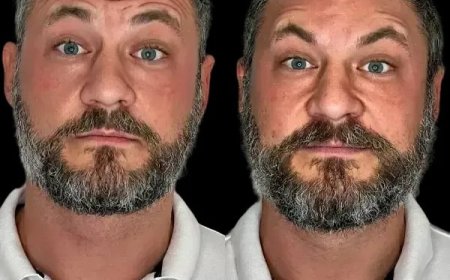 Emerge Glowing with Profhilo in Dubai