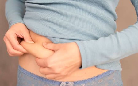 Inside the Liposuction Experience Advice from Best Liposuction Surgeons in Dubai