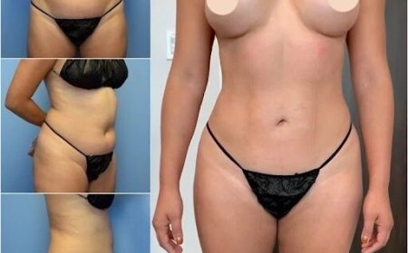 Body Contouring in Dubai: Achieving Precision and Perfection