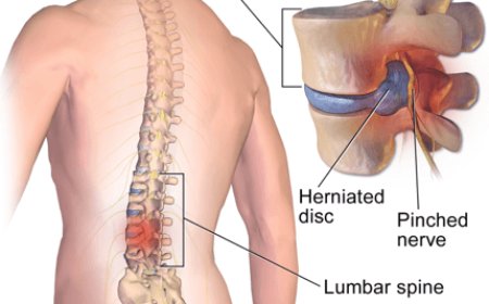 Aspadol 200 mg vs. Tramadol: Which Is More Effective?