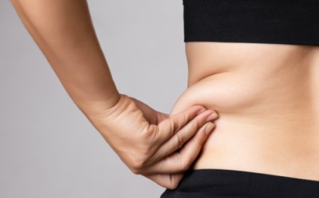 Smooth Recovery in Dubai What Doctors Recommend After Liposuction Surgery