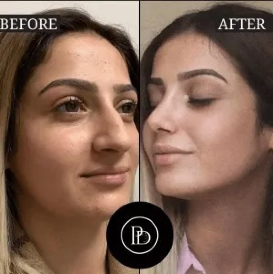 From Tired to Radiant: PRP Treatment in Dubai Results